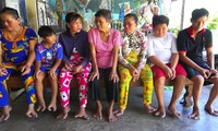 Gia đình 3 thế hệ tay chân chỉ 2- 3 ngón ở miền Tây