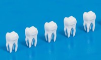 Cấy ghép răng bằng tế bào gốc: Chấm dứt trám răng, đau đớn khi điều trị tủy 