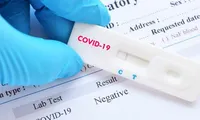 Lều dã chiến xét nghiệm nhanh COVID-19 tại Hà Nội được đặt ở đâu?