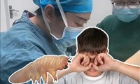 Trung Quốc: Dụi mắt cho &quot;đã&quot;, hơn 80 con ve &quot;làm tổ&quot; trong mắt cậu bé 13 tuổi