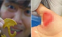 3 học sinh nhập viện vì làm theo trò chơi trong &quot;Squid Game&quot;, Úc cảnh báo phụ huynh