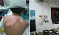 Dùng bột soda để thông đường ống thoát nước bồn rửa, làm nổ luôn đường ống nhà hàng xóm