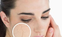 Mùa lạnh hanh khô nên ăn những thực phẩm này bởi giữ ẩm cực tốt