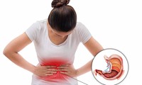 Những thói quen sai lầm có thể khiến dạ dày của bạn bị ăn mòn, viêm loét, gây đau đớn