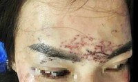 Khởi tố vụ án người phụ nữ &apos;tố&apos; bị bắt giữ, đánh đập, xăm mặt vì ghen 