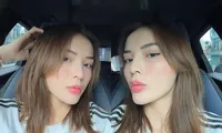 Khoe làn da ở tuổi 27, Hoa hậu Kỳ Duyên bị soi ra một chi tiết hài hước trên khuôn mặt