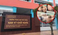 Nam sinh lớp 10 ở TP.HCM bị bạn đánh vỡ xương sọ, không thể tham dự kỳ thi cuối học kỳ