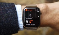 Apple Watch lập công giúp cứu người phụ nữ khỏi cục máu đông nguy hiểm