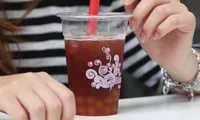 Loại bỏ 300 viên sỏi thận từ cô gái trẻ uống trà sữa thay nước