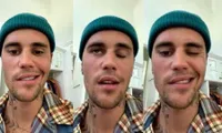 Justin Bieber bị liệt nửa mặt do nhiễm vi-rút hiếm gặp, phải hủy toàn bộ show diễn