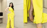 Vết thương ở bàn chân trái của Hoa hậu Thiên Ân hiện giờ ra sao?