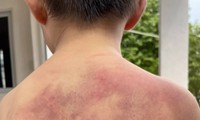 Người cha đánh đập con trai tàn nhẫn vì ‘không học bài’