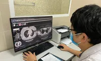 Phổi của bệnh nhân bị hậu COVID-19