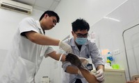 Bỏng điện phá huỷ từ bên trong: Cảnh báo hậu quả khó lường từ ca bệnh của nạn nhân 37 tuổi