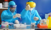 Cô gái bị tái dương tính và 20 lần xét nghiệm tìm SARS-CoV-2