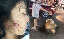 Ba phụ nữ bị khởi tố vì lột đồ đổ nước mắm vào người cô gái trẻ