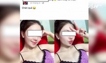 Cô gái 22 tuổi chết thương tâm vì phẫu thuật nâng ngực
