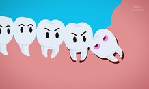 Sự tích răng khôn và vì sao chúng hành hạ con người đến vậy?