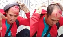 Kẻ mang kích điện xông vào tiệm vàng chích chủ tiệm, cướp 500 triệu đồng là ai?