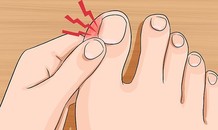 Vì sao va đập nhẹ ở ngón chân lại làm chúng ta đau 'thấu trời'?