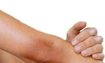 Cách trị vết thâm ở đầu gối và khuỷu tay