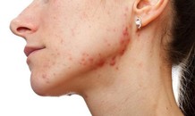 7 dấu hiệu cảnh báo cơ thể chứa đầy độc tố