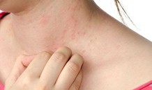 Tia cực tím, ô nhiễm gia tăng kéo theo ung thư da