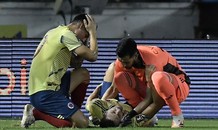 James Rodriguez ôm đầu vì chấn thương kinh hoàng của sao Colombia