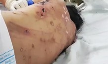 Nữ tiếp viên tố bị chủ ép bán dâm, đánh gãy xương, tra tấn như thời trung cổ