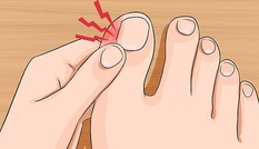 Vì sao va đập nhẹ ở ngón chân lại làm chúng ta đau 'thấu trời'?