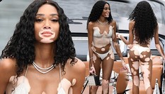 Siêu mẫu Winnie Harlow diện bikini nhảy múa trên du thuyền triệu đô