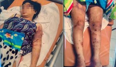 Ghê rợn vụ tra tấn thai phụ: Bắt nạn nhân hít ma tuý, dùng ná bắn vào vùng kín