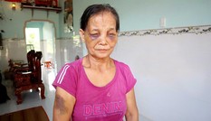 Con dâu bị tố đánh mẹ chồng sưng mặt sau khi cãi vã