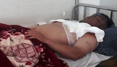Bị hất cả nồi lẩu đang sôi vào mặt vì hỏi tuổi phụ huynh