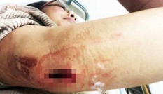 Nữ chủ quán cà phê bị nhóm đòi nợ thuê chém gục