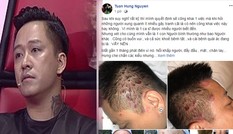 Showbiz 22/6: Tuấn Hưng suy sụp vì bị bệnh 'khó lòng chữa khỏi'