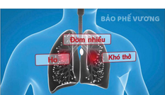 Ho, đờm kéo dài do viêm phế quản phải làm sao?