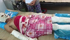Phát nổ do rò rỉ khí ga trong đám tang, 5 người bỏng nặng