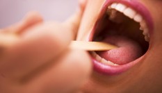 Căn bệnh ung thư 'sát thủ' có dấu hiệu ban đầu chỉ là ... viêm họng