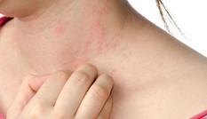 Tia cực tím, ô nhiễm gia tăng kéo theo ung thư da