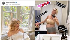 Emma Roberts tiết lộ giới tính con đầu lòng, Katy Perry với trang phục lót sau sinh 5 ngày