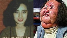 Bi kịch ‘thảm họa thẩm mỹ’ Hàn Quốc: Từ mỹ nhân hóa 'quái vật'
