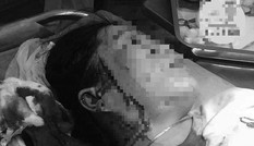 Hẹn đánh ghen, người đàn bà bị đâm, rạch nát mặt
