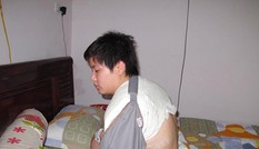 Gãy xương vì xô xát với công an?