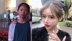 Mới 14 tuổi đã chi hơn 3 tỷ đồng, chịu phẫu thuật thẩm mỹ 300 lần để “trông giống búp bê”