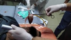 Một người bị con cá sống chui vào cổ họng suýt ngạt thở, lý do thì bạn không tin nổi đâu