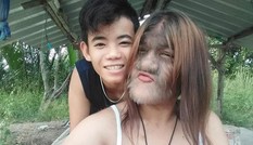 Vừa chia tay chồng sắp cưới, “cô gái người sói” Thái Lan khoe ảnh bên bạn trai mới