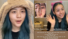 Hot TikToker “trứng rán cần mỡ” vẫn bị dân mạng nghi ngờ dù đã can đảm công khai mặt mộc