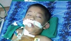 Bị đàn ong tấn công, cháu bé nhập viện trong tình trạng nguy kịch.