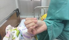 Mổ thành công cho nữ sinh cột sống ngoằn ngoèo như rắn lượn